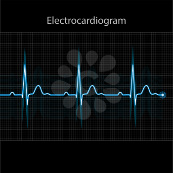 Electrocardiogram 2d illustration on black background, vector, eps 10