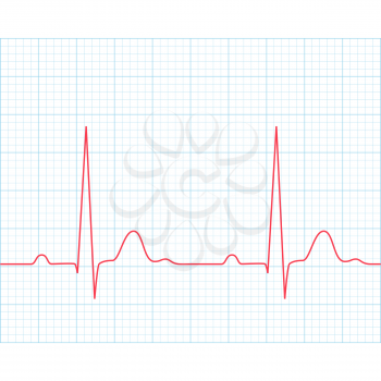 Medical electrocardiogram - ECG on grid paper, graph of heart rhythm, 2d illustration, vector, eps 8
