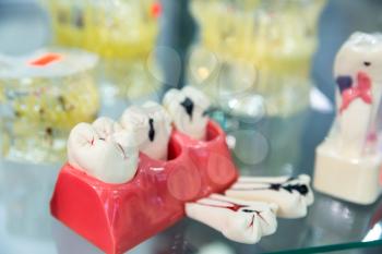 Denture treatment, prosthetic dentistry, medicine equipment. Dentist cabinet, stomatology. Tooth care mouth hygiene