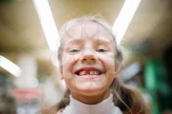 Smiling little girl without tooth, childrens happiness in pet shop. Kid customer in petshop
