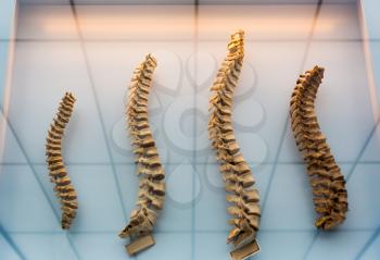 Model of a human spine, learning of the human spinal columns. Anatomy, medical education concept