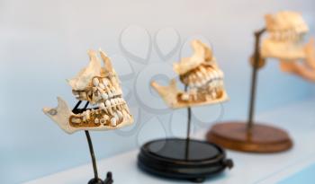 Medical models of the human jaws on the stand. Learning of the human mouth structure. Anatomy, teeth education concept