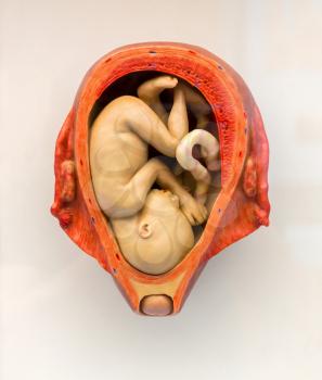 Human embryo in the womb, reproduction. Embryogenesis information poster, embryonic development, pregnancy period