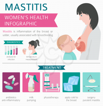 Mastitis, breastfeed, medical infographic. Diagnostics, symptoms, treatment. Women`s health icon set. Vector illustration