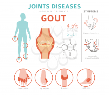Joints diseases. Gout symptoms, treatment icon set. Medical infographic design. Vector illustration