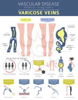 Vascular diseases. Varicose veins symptoms, treatment icon set. Medical infographic design. Vector illustration