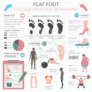 Foot deformation as medical desease infographic. Causes of Flat foot. Vector illustration