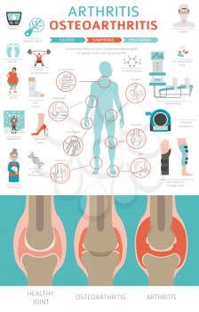 Joints diseases. Arthritis, osteoarthritis symptoms, treatment icon set. Medical infographic design. Vector illustration