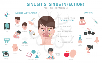 Nasal diseases. Sinusitis, sinus infection diagnosis and treatment medical infographic design. Vector illustration