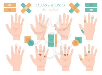 Callus, corn and blister feet and hands. Dermatology. Medical desease infographics collection. Vector illustration