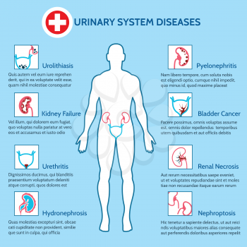 Urinary system diseases. Medical infographics of urinary system vector illustration