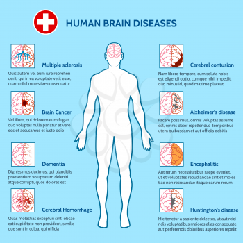 Mental Health and human brain diseases medical infographics vector illustration