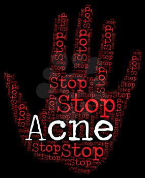 Stop Acne Representing Warning Sign And Rosacea