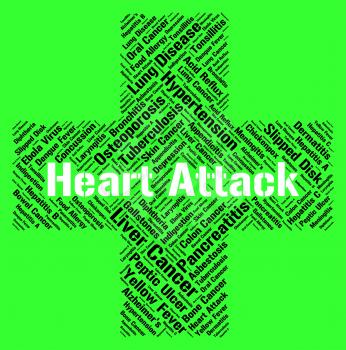 Heart Attack Representing Acute Myocardial Infarction And Acute Myocardial Infarction