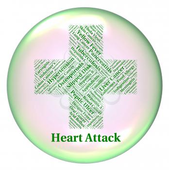 Heart Attack Showing Acute Myocardial Infarction And Acute Myocardial Infarction