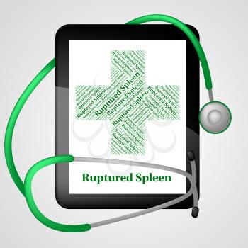 Ruptured Spleen Meaning Splenic Injury And Attack