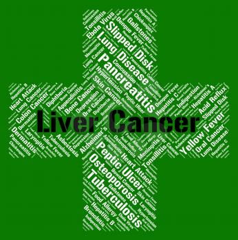 Liver Cancer Showing Malignant Growth And Malignancy