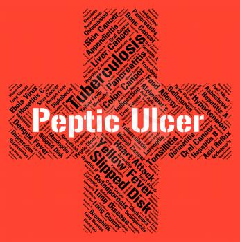 Peptic Ulcer Indicating Canker Sore And Afflictions