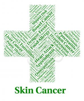 Skin Cancer Showing Malignant Growth And Ailments