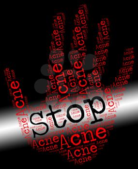 Stop Acne Meaning Warning Sign And Stops