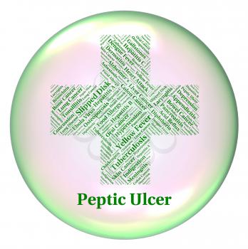 Peptic Ulcer Representing Lower Esophagus And Pud