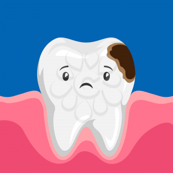 Illustration of sick tooth with caries. Children dentistry sad character. Kawaii facial expression.