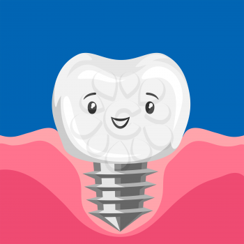 Illustration of ssmiling tooth implant. Children dentistry happy character. Kawaii facial expression.