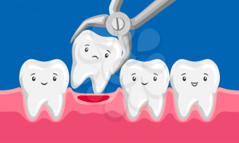 Illustration tooth is removed by forceps in oral cavity. Children dentistry characters. Kawaii facial expressions.