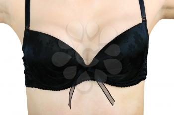 Concept of breast augmentation. Women's breasts after breast augmentation surgery