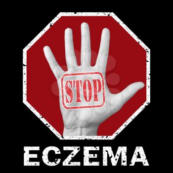Stop eczema conceptual illustration. Open hand with the text stop eczema