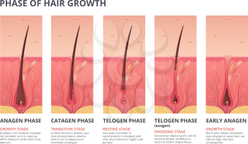 Medical infographic illustrations of hair growth cycle. Vector pictures of human biology. Hair human banner, anatomy root follicle