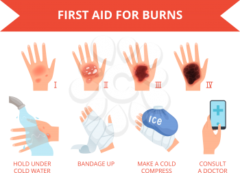 Burn skin. First treatment human hand fire or chemical destruction injury graviera skin safety for persons vector infographic. Injury degree, bandage on damage body, classification illustration