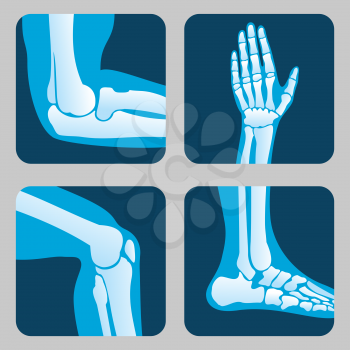 Human joints, knee joint, elbow joint, ankle joint, wrist. Medical orthopedic vector of set. Anatomy orthopedic human joint and illustration icon leg and hand joint