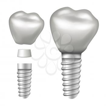 Dental Implant Vector. Molar Human Teeth. Dental Clinic Stomatology Flyer. Realistic Isolated Illustration