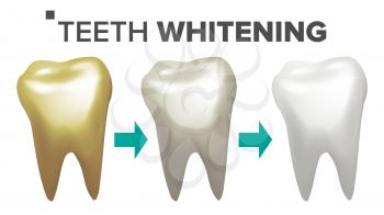 Teeth Whitening Vector. Before And After View Of Teeth Whitening. Dental Technician Concept. Isolated Illustration