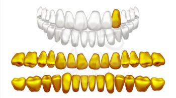 Golden Tooth Vector. Metal Gold Human Teeth. Isolated Illustration