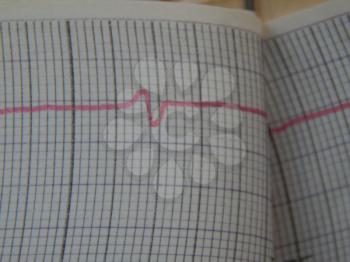 Scientific charts, cardiograms and mathematical calculations