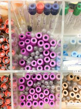 Blood test sample vials at medical laboratory close up
