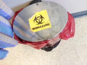 Stainless steel biohazard trash can medical office with red plastic bag