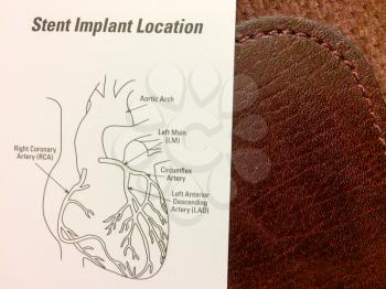 heart diagram stent implant location with text copy space